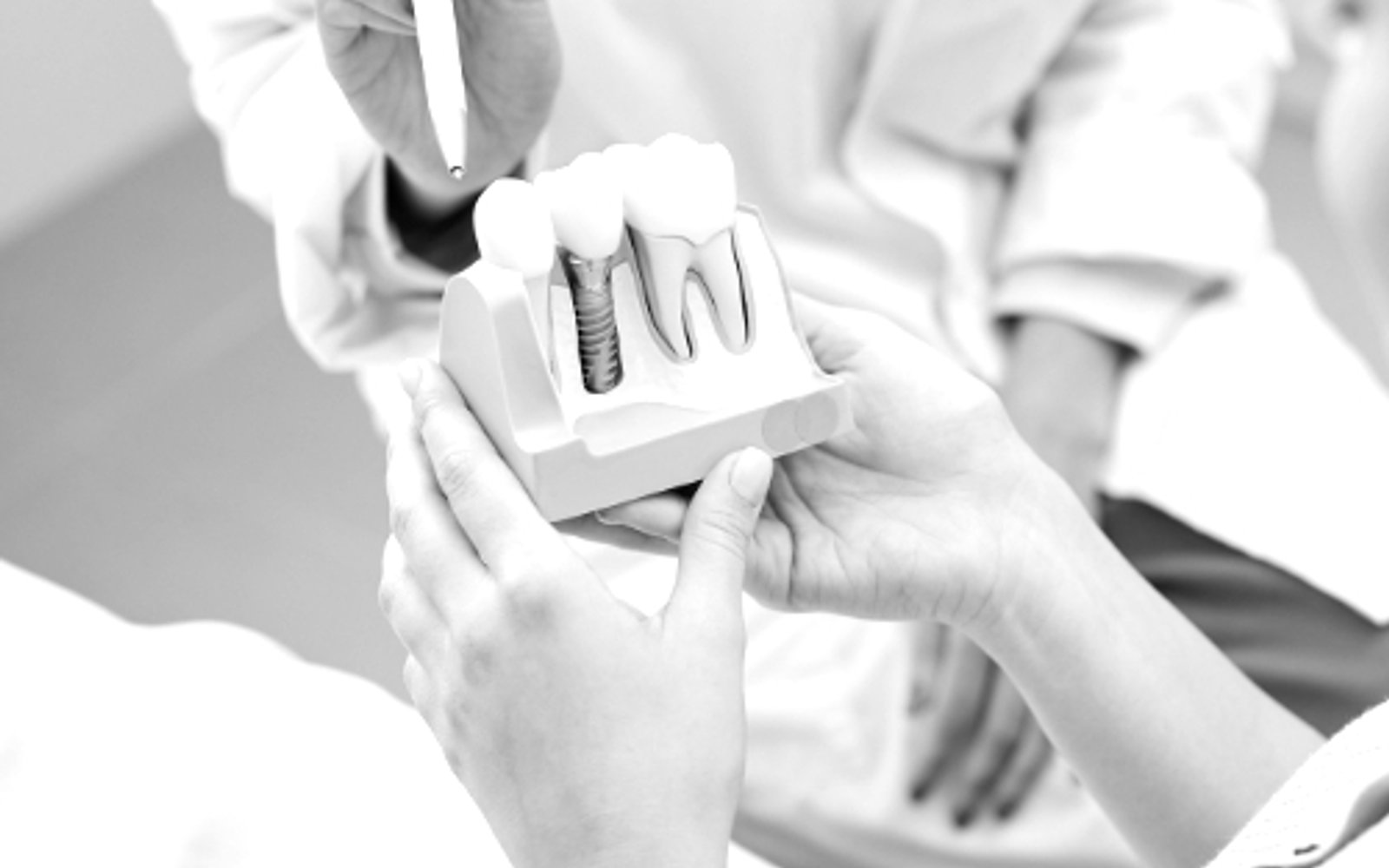 Dental implant treatment at Krest Dental