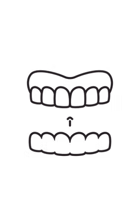 Invisalign clear aligners at Krest Dental